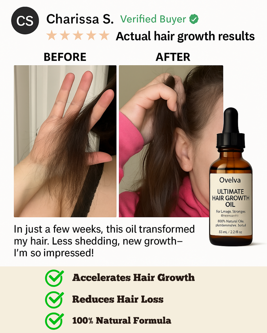 Ovelya® The Ultimate Hair Growth Oil
